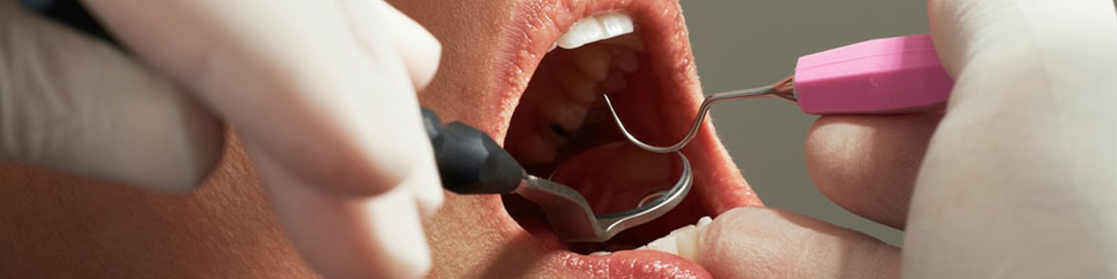 Dr. ARUN K G  <br> MBBS, MD (General Medicine), DNB (Nephrology)