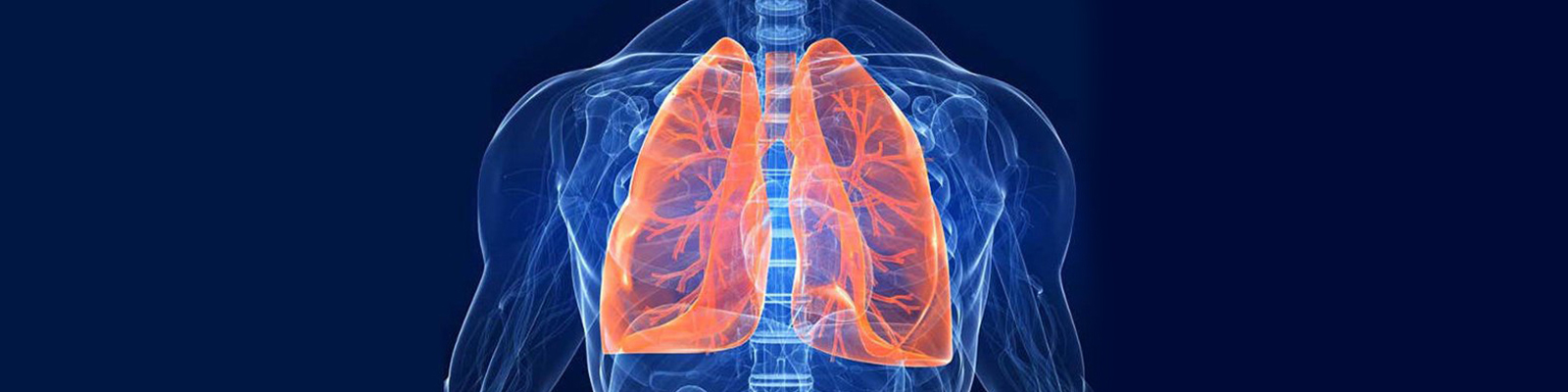 Dr. SUYOG YOGANNA  <br> MBBS, MD (Respiratory Medicine)